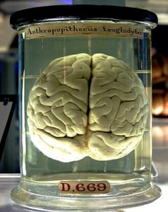 Marathon Running Temporarily Reduces Brain Myelin Levels, Study Finds